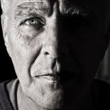 Fusidinsyre-resistente Staphylococcus aureus hos patienter med atopisk dermatitis