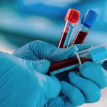 hands of a doctor taking samples of blood